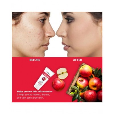 LA Organo Apple Cider Vinegar Face Wash, 100g & Vit C Face Serum with 20% Vit C, 30ml For Anti Ageing & Skin Brightening Combo